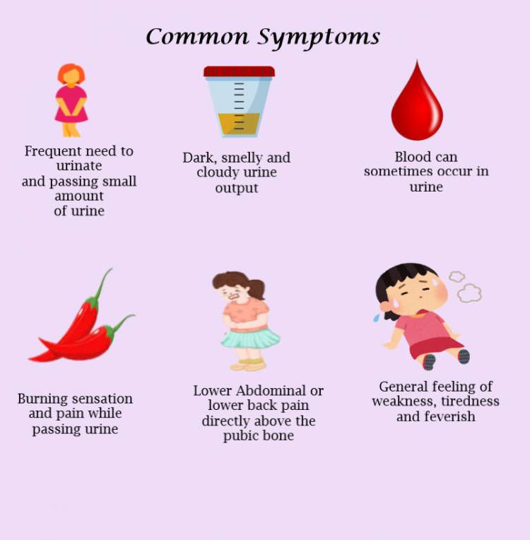 Symptoms of cystitis, Do i have cystitis, How to know if i have cystitis